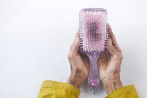 Cómo detener la caída del cabello: causas, tratamientos y remedios