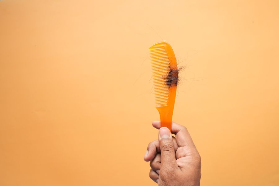 perdida cabello soluciones capilares 1 Pérdida de cabello y soluciones capilares
